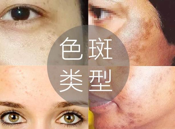食疗食谱，促进皮肤自我修复秘诀