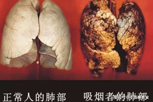 烟草背后的真相，肺部受损的警示钟敲响