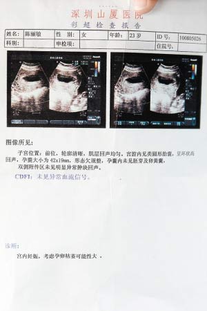 怀孕八周探未知，挑战中的希望与胎儿寻找之旅